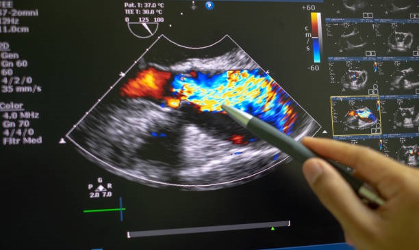colour doppler in andheri