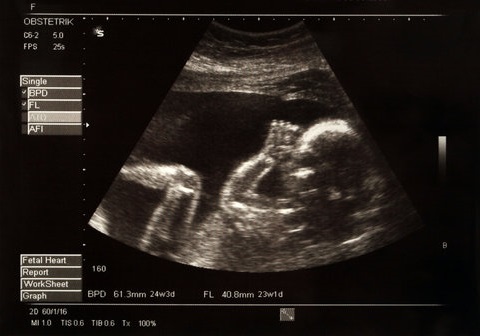 sonography in andheri